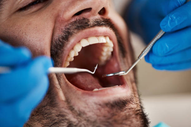 Best Walk-In Emergency Dentist in Arroyo Grande, CA